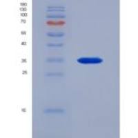 小鼠Pyruvate Dehydrogenase Kinase 4 (PDK4)重组蛋白