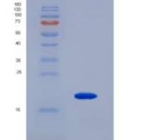 小鼠Carbonic Anhydrase VB, Mitochondrial (CA5B)重组蛋白