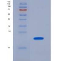 人尼克酰胺腺嘌呤二核苷酸磷酸氧化酶4(NOX4)重组蛋白