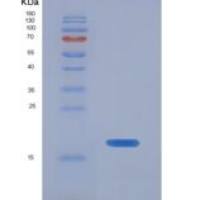 人食道癌相关基因4(ECRG4)重组蛋白
