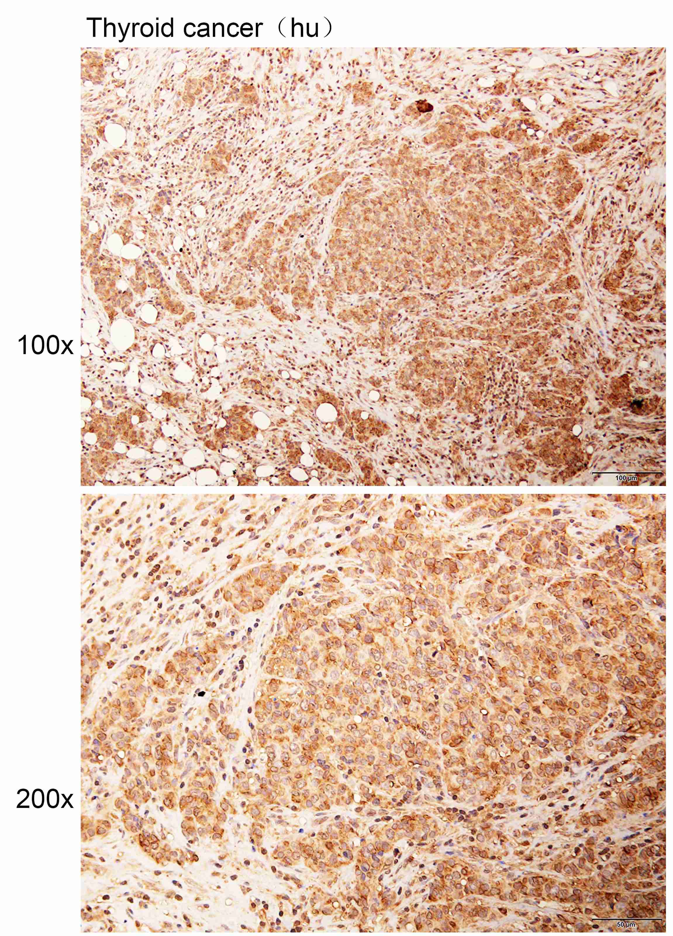 K113774P Anti-VAPA Polyclonal 