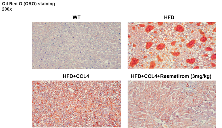 MASH（NASH）小鼠