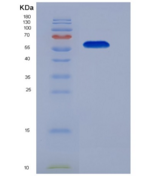 小鼠含IQ基元GTP酶激活蛋白1(IQGAP1)重组蛋白
