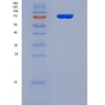 人凝溶胶蛋白(GSN)重组蛋白
