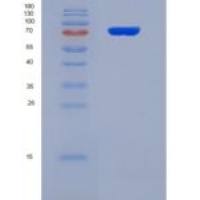 人凝溶胶蛋白(GSN)重组蛋白