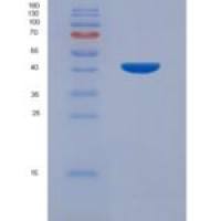 人细胞外信号调节激酶2(ERK2)重组蛋白