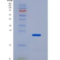 大鼠甲状旁腺素受体1(PTHR1)重组蛋白