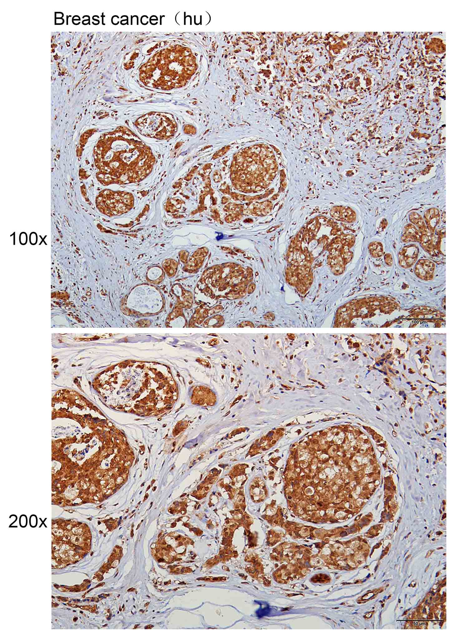K113921P Anti-CCR3 Polyclonal 