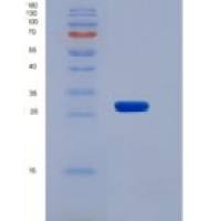 人肝受体同源物1(LRH1)重组蛋白
