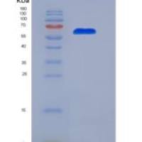 人核糖核酸酶H(RNASEH)重组蛋白