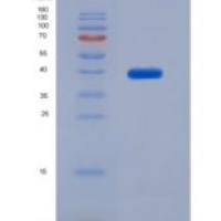 大鼠血管紧张素Ⅱ受体1(AGTR1)重组蛋白