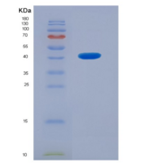 人ⅣD组磷脂酶A2(PLA2G4D)重组蛋白