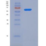 人无翅型MMTV整合位点家族成员2B(WNT2B)重组蛋白