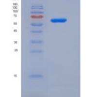 人无翅型MMTV整合位点家族成员2B(WNT2B)重组蛋白