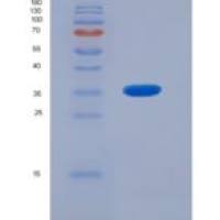 大鼠集聚蛋白(AGRN)重组蛋白