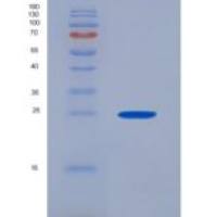 小鼠踝蛋白(TLN1)重组蛋白