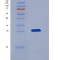 人酶原颗粒膜糖蛋白(GP2)重组蛋白