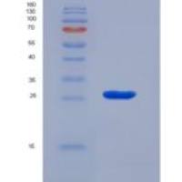 大鼠脊椎蛋白1(SPON1)重组蛋白