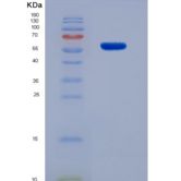 小鼠抑瘤素M受体(OSMR)重组蛋白