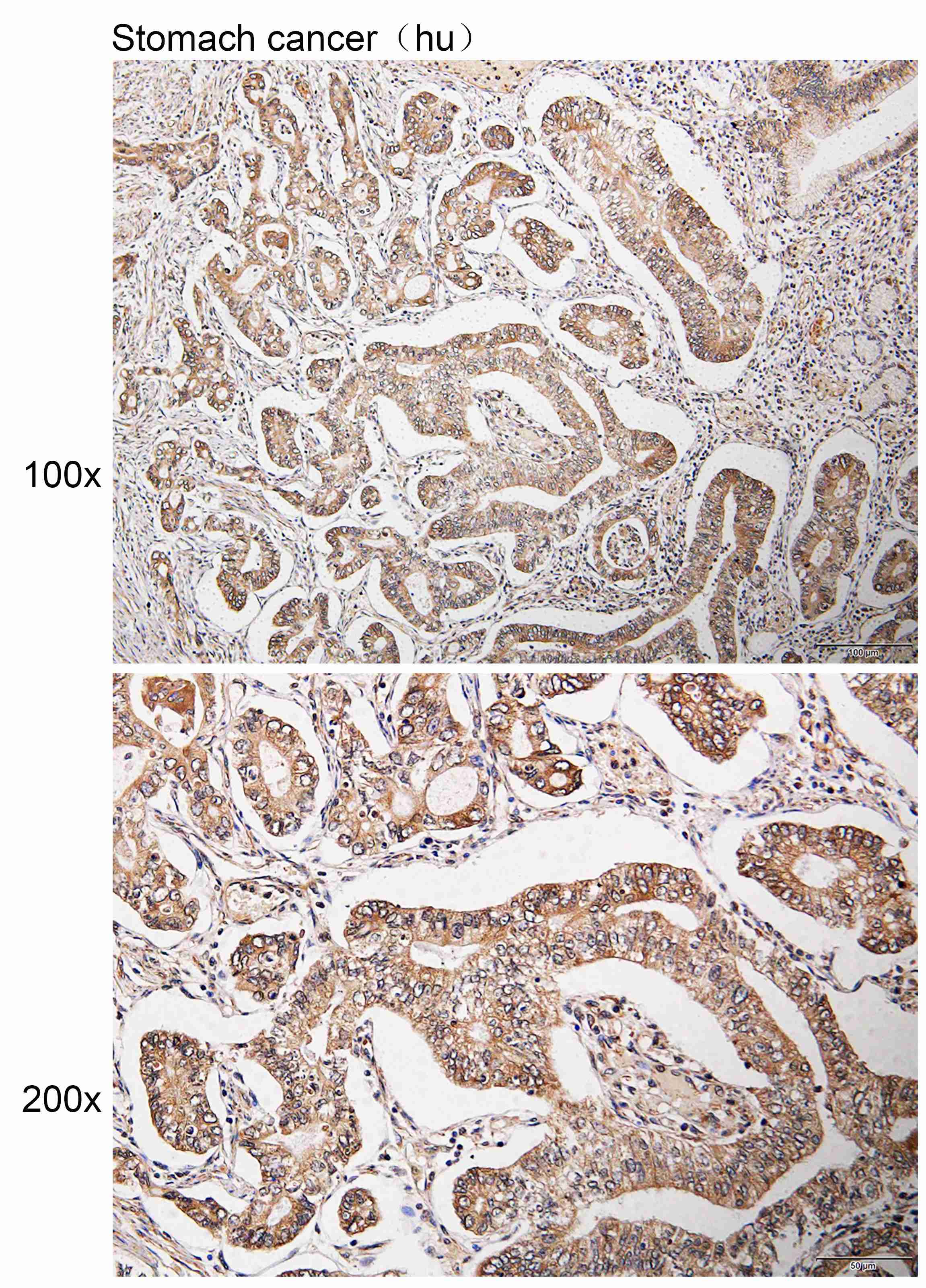 K113774P Anti-VAPA Polyclonal 
