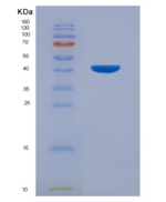 人细胞外信号调节激酶2(ERK2)重组蛋白