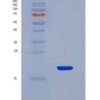大鼠脂肪酸结合蛋白 4(FABP4)重组蛋白