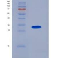 小鼠Ⅰ型胶原α1(COL1a1)重组蛋白