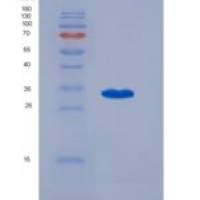 人RAR相关孤儿素受体α(RORa)重组蛋白