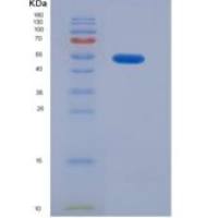 人心肌肌钙蛋白T(TNNT2)重组蛋白