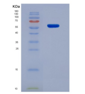 小鼠抑瘤素M受体(OSMR)重组蛋白