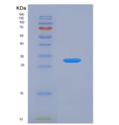 小鼠肾损伤分子1(Kim1)重组蛋白
