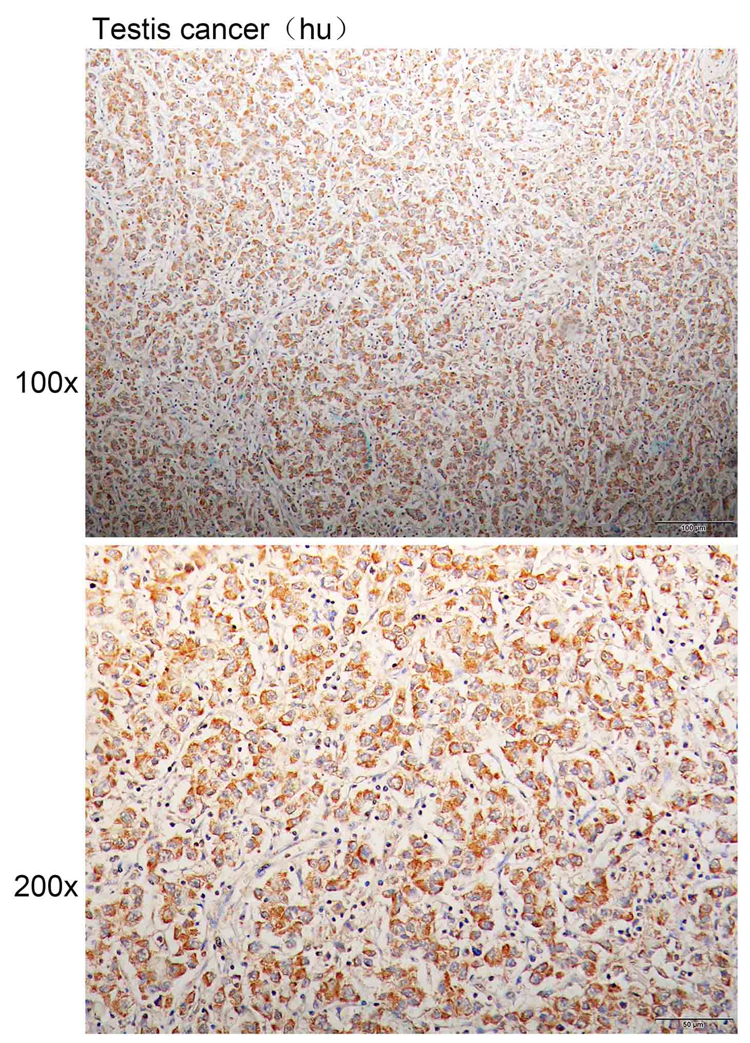 K113864P Anti-PRKAA1/PRKAA2 Po