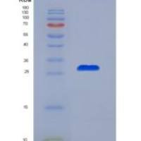 小鼠甲状腺球蛋白(TG)重组蛋白