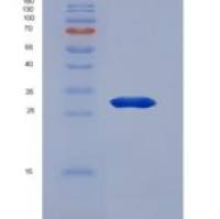 人含F-框WD重复域蛋白7(FBXW7)重组蛋白