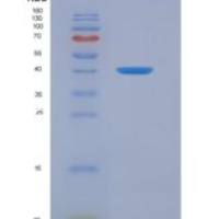 人肌酸激酶B（CK-BB）重组蛋白