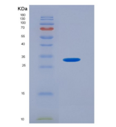 大鼠芳香烃受体(AhR)重组蛋白