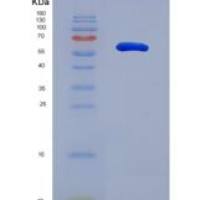 人溶质载体家族26成员7(SLC26A7)重组蛋白