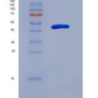 人蛋白精氨酸甲基转移酶1(PRMT1)重组蛋白