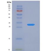 小鼠肾损伤分子1(Kim1)重组蛋白