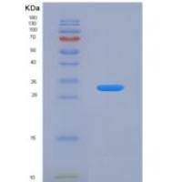 小鼠肾损伤分子1(Kim1)重组蛋白