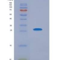 人整合素α2(ITGa2)重组蛋白