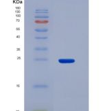 人琥珀酸脱氢酶复合体B亚基(SDHB)重组蛋白