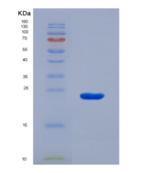 人载脂蛋白E(APOE)重组蛋白