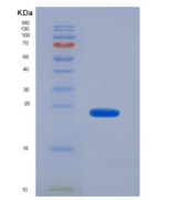 人CD8a分子(CD8a)重组蛋白