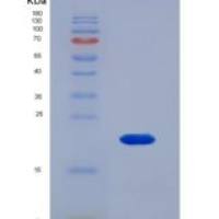 小鼠Carbonic Anhydrase VA (CA5A)重组蛋白