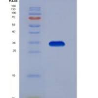 小鼠分泌型卷曲相关蛋白2(SFRP2)重组蛋白