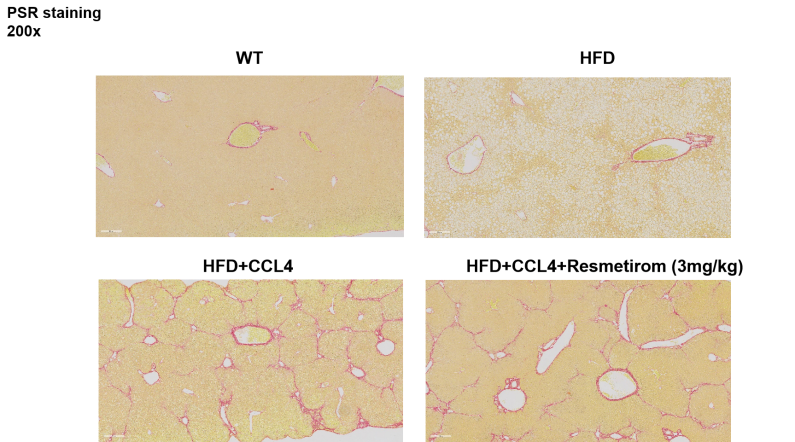 HFD+CCl4诱导的代谢功能障碍相关性脂肪肝炎MASH（NASH）小鼠