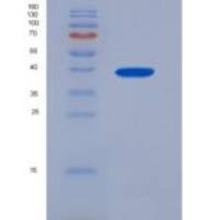 人三叶因子3(TFF3)重组蛋白