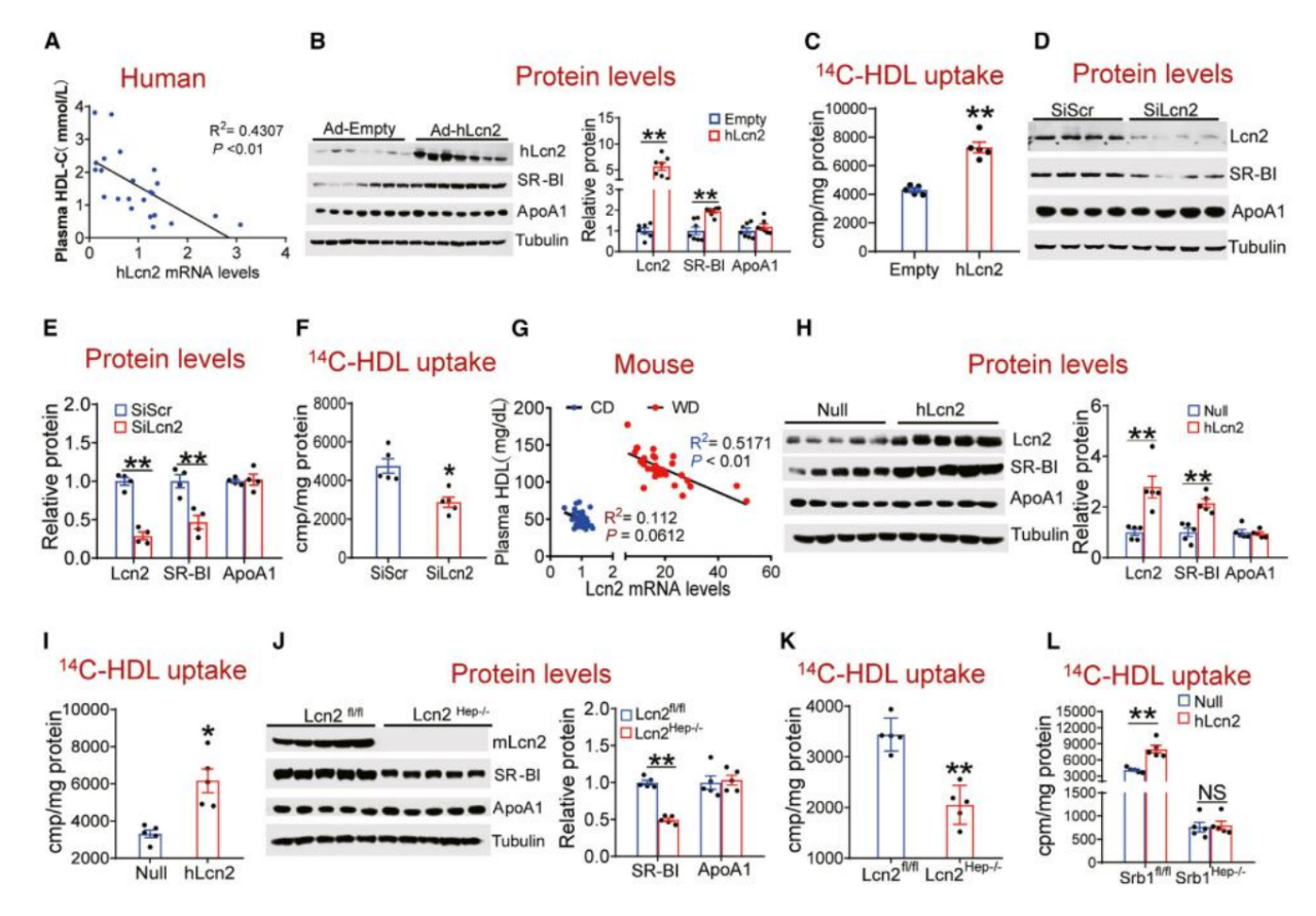 复旦大学徐延勇等团队发现动脉粥样硬化的关键调节因子