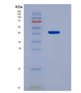 人白介素12B(IL12B)重组蛋白